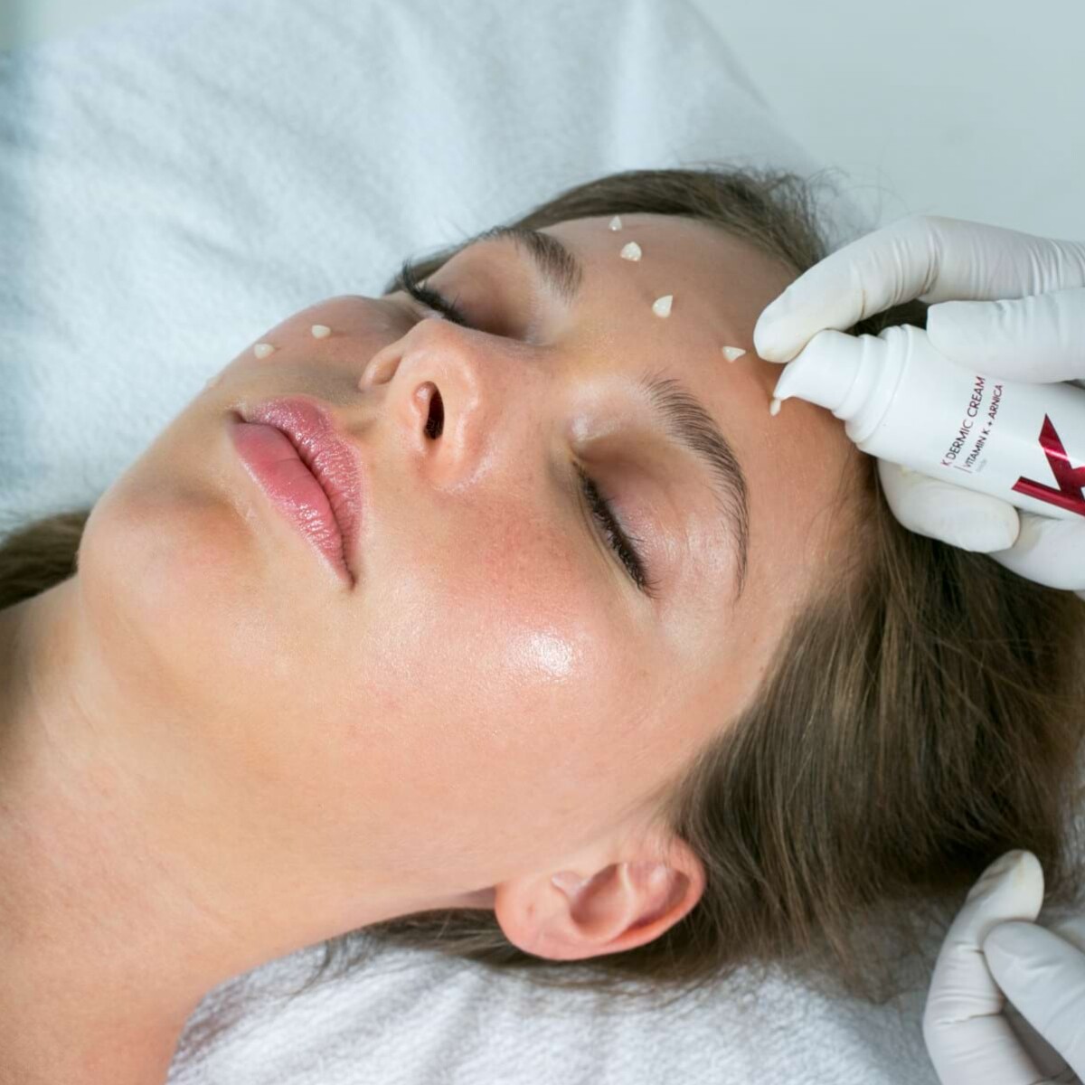 dermica, K Dermic Cream